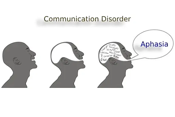 aphasia is written in the pic with people having speech disorder