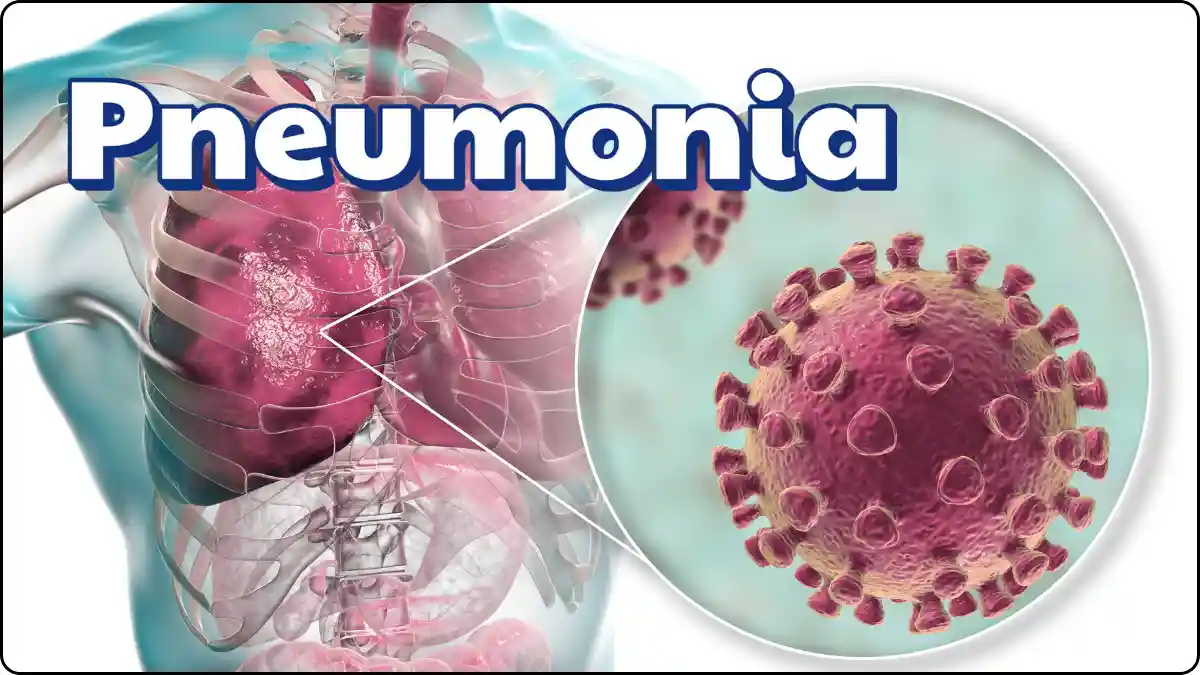 Walking pneumonia