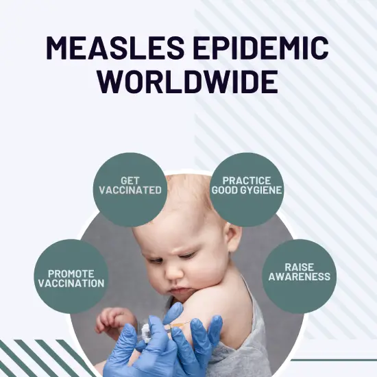 measles prevention