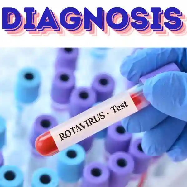 rotavirus gastro diagnosis 