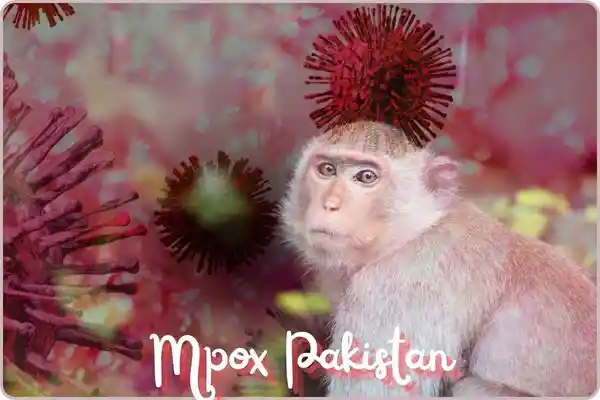 Mpox Pakistan is written in the picture