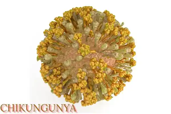 CHIKUNGUNYA