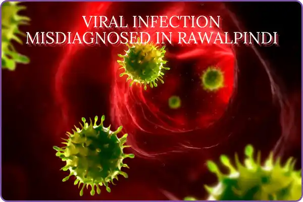 viral infection misdiagnosed in Rawalpindi with MERS -C0V